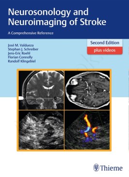 Neurosonology and Neuroimaging of Stroke: A Comprehensive Reference Neurosonology and Neuroimaging of Stroke: A Comprehensive Reference thumb 2 1